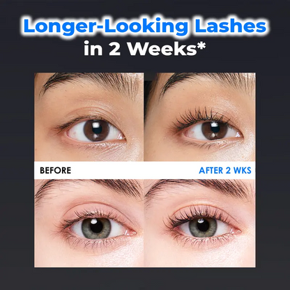 Essential Eyelash Growth Serum, Jumbo Size 0.5fl.oz - Safe & Gentle Lashes Care, Fuller, Thicker in 2 Weeks, Non-Prostaglandin