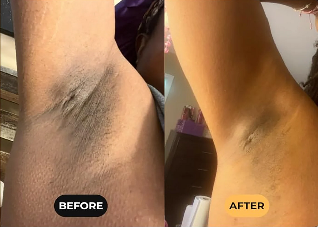Give Rough Spots More Attention